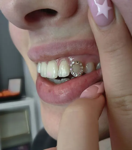 Kryształki Tooth Gems ułożone w ozdobny wzór na zębie
